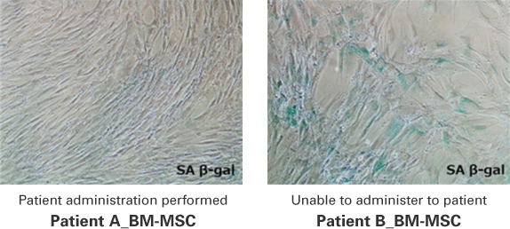 Patient administration performed Patient A_BM-MSC Unable to administer to patient Patient B_BM-MSC